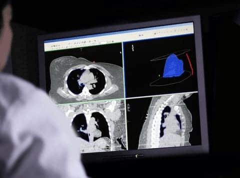 Radiologist reviewing medical imaging