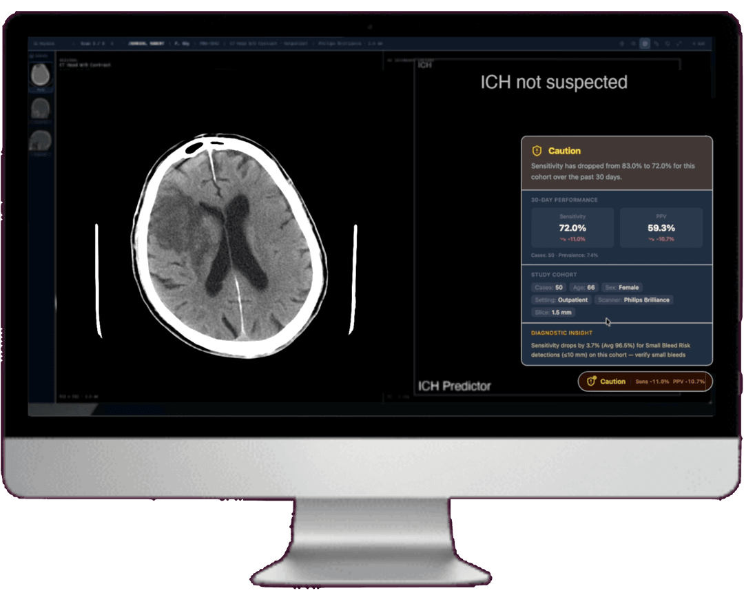 PACS Reader with AI Integration